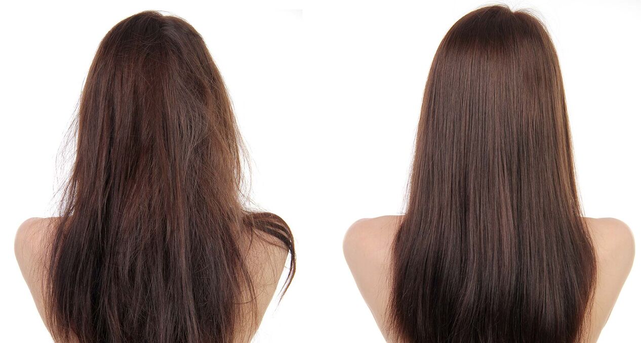 Hair recovery